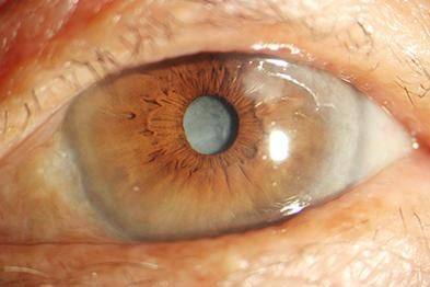 广州华厦维尔视眼科医生团队实力强大及骨干医生简介