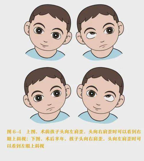 深圳普瑞眼科医院（星耀店）是正规医院吗？