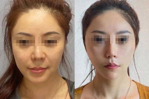 石家庄爱瑞尔整形医院详细的预约挂号方式及流程