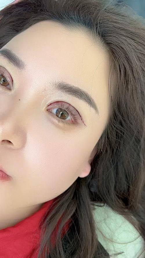 广西奢梵医疗美容有限公司南宁医疗美容门诊部真人口碑评价怎么样？