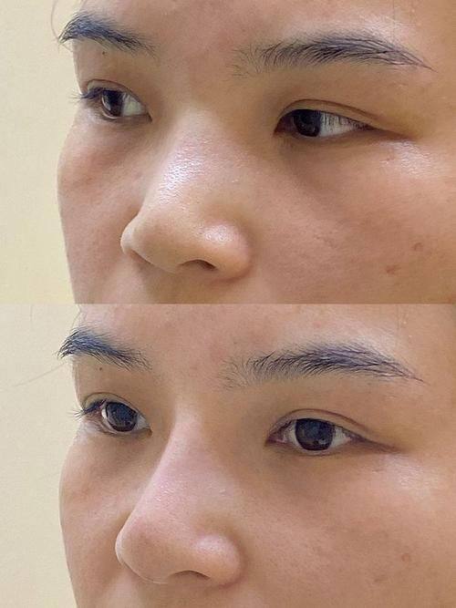 大连易美佳整形医疗美容门诊真人口碑评价怎么样？