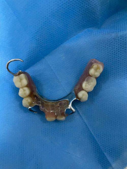 金华雅艺口腔收费价格表/收费标准