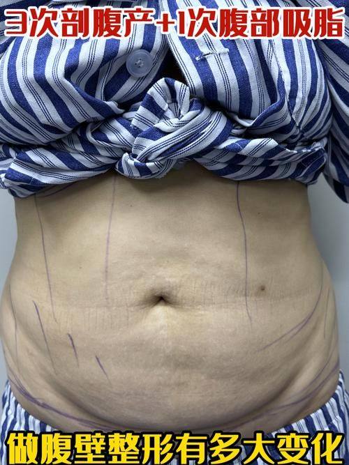 广西奢梵医疗美容有限公司南宁医疗美容门诊部地址电话营业时间