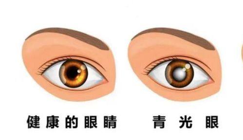 包头麦迪格眼科医院详细的预约挂号方式及流程