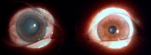 营口经济技术开发区中 心医院眼科真人口碑评价怎么样？