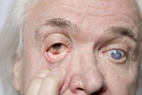 包头麦迪格眼科医院特色项目及技术优势