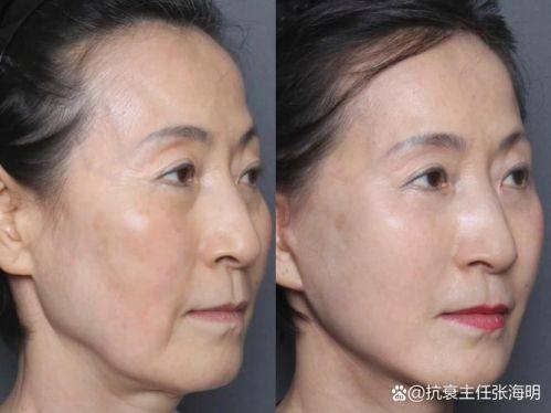 石家庄爱瑞尔整形医院特色项目及技术优势