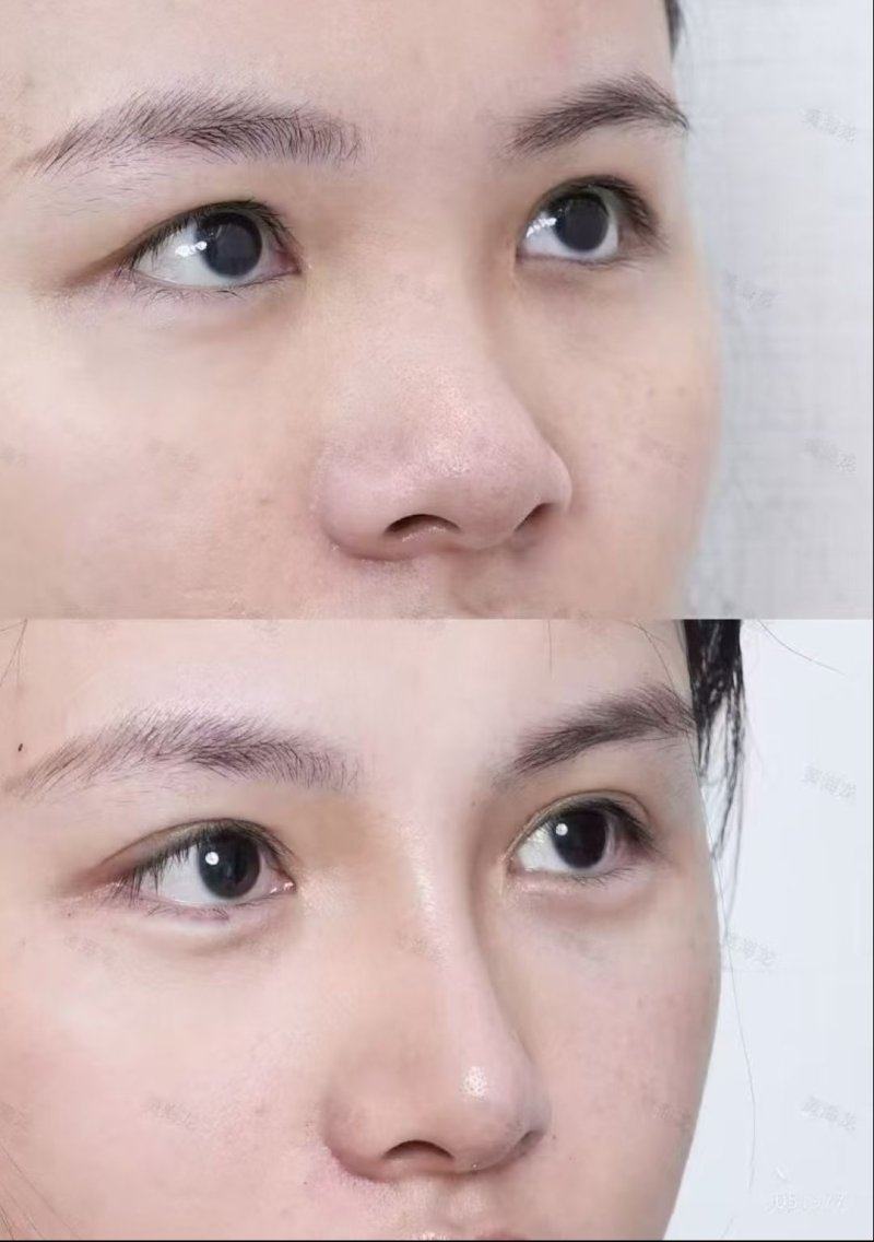 大连易美佳整形医疗美容门诊收费价格表/收费标准