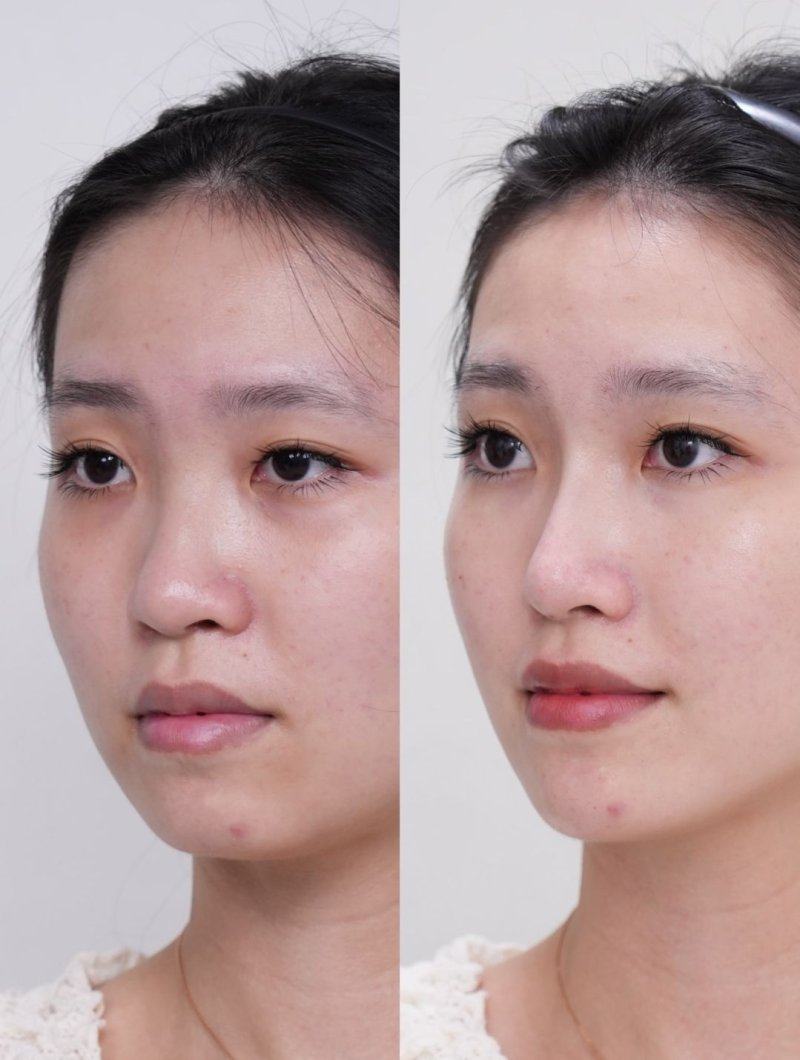 广西奢梵医疗美容有限公司南宁医疗美容门诊部收费价格表/收费标准