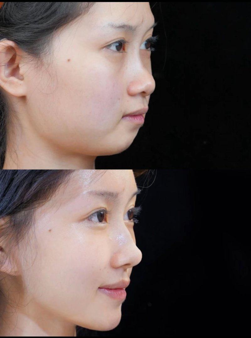 广西奢梵医疗美容有限公司南宁医疗美容门诊部是正规医院吗？