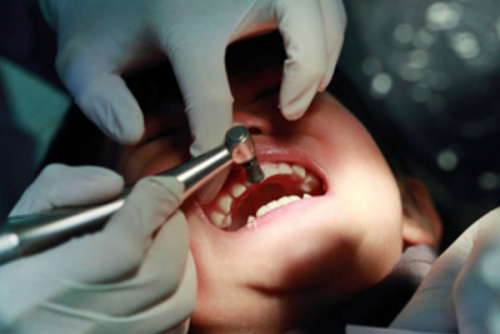 江西景德镇乐平益齿口腔诊所特色项目及技术优势