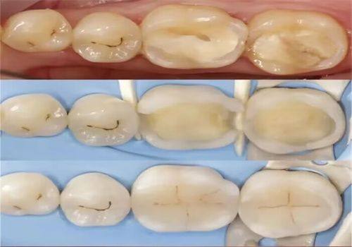 江西景德镇乐平益齿口腔诊所真人口碑评价怎么样？