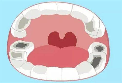 鄂尔多斯瞿英楠口腔诊所真人口碑评价怎么样？