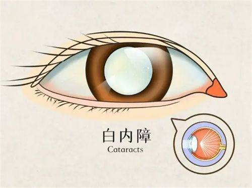 诸城光明眼科医院收费价格表/收费标准