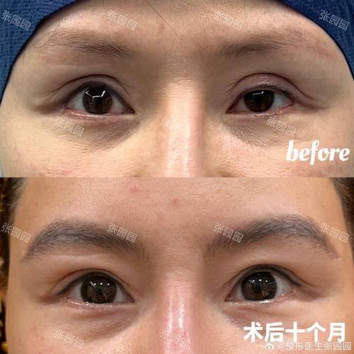 深圳柏悦整形医疗美容门诊部真人口碑评价怎么样？