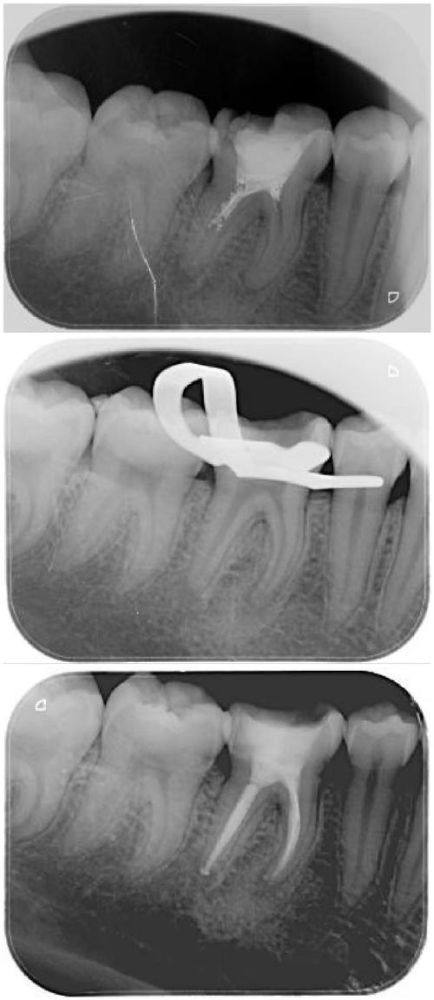 鄂尔多斯瞿英楠口腔诊所详细的预约挂号方式及流程