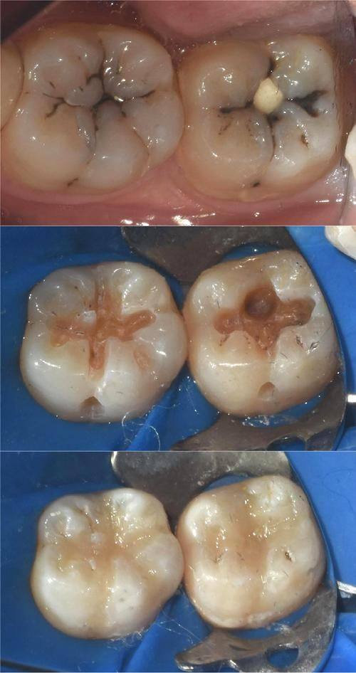 浙江杭州博美口腔是正规医院吗？