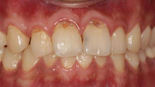 江西景德镇乐平益齿口腔诊所详细的预约挂号方式及流程