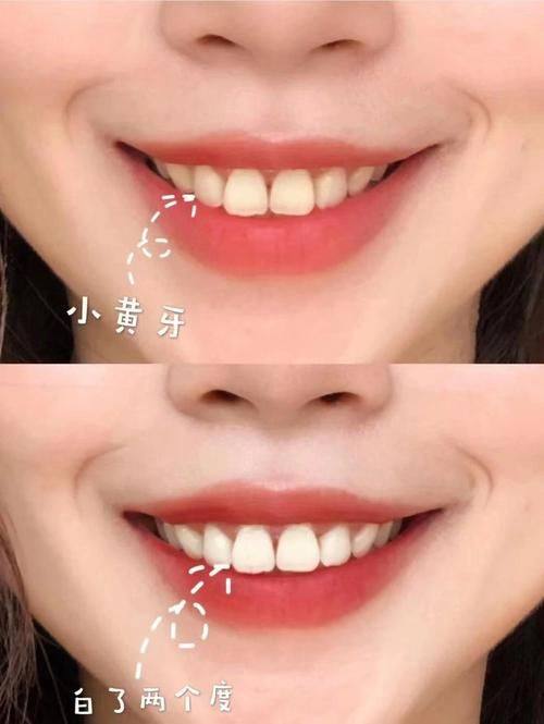 鄂尔多斯瞿英楠口腔诊所地址电话营业时间