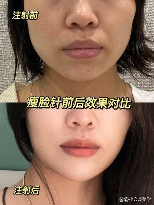 深圳博济门诊部美容科详细的预约挂号方式及流程