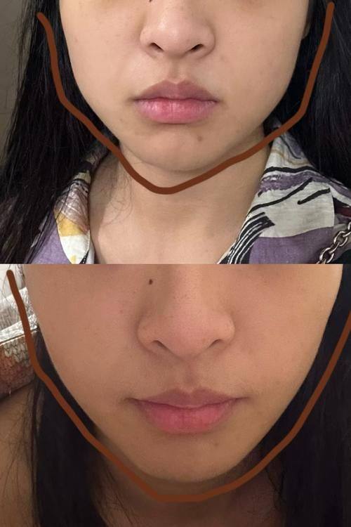 深圳博济门诊部美容科收费价格表/收费标准