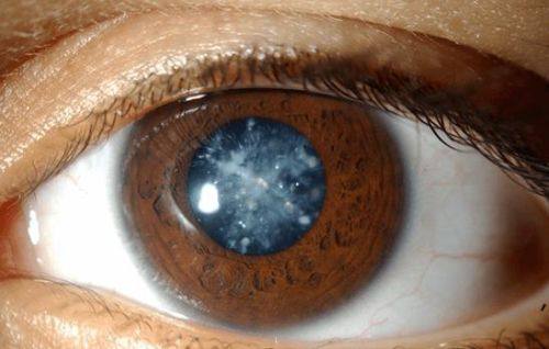 诸城光明眼科医院详细的预约挂号方式及流程