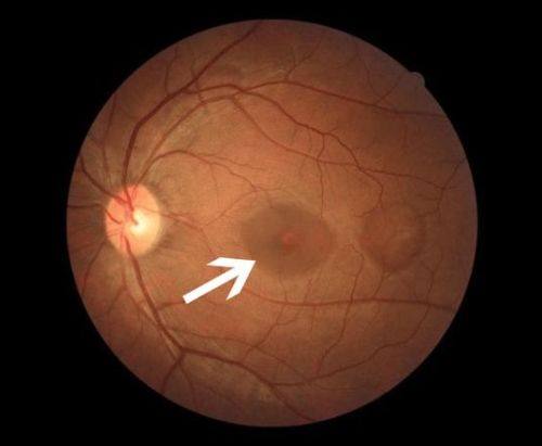 诸城光明眼科医院医生团队实力强大及骨干医生简介