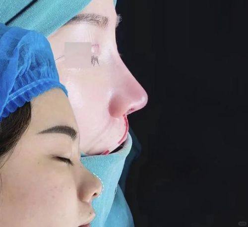 深圳柏悦整形医疗美容门诊部地址电话营业时间