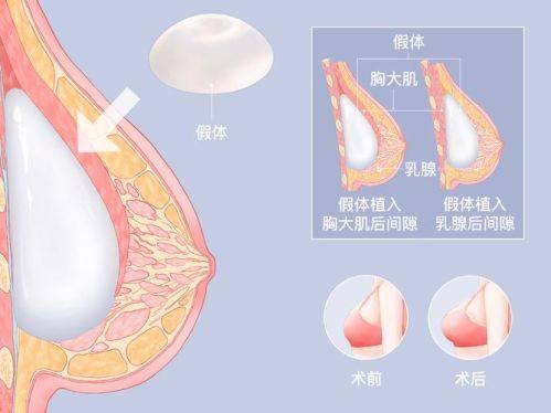 深圳柏悦整形医疗美容门诊部收费价格表/收费标准