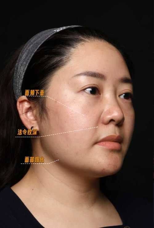 深圳柏悦整形医疗美容门诊部医生团队实力强大及骨干医生简介