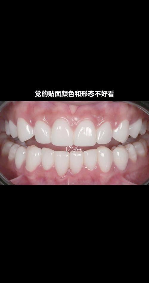 浙江杭州博美口腔真人口碑评价怎么样？