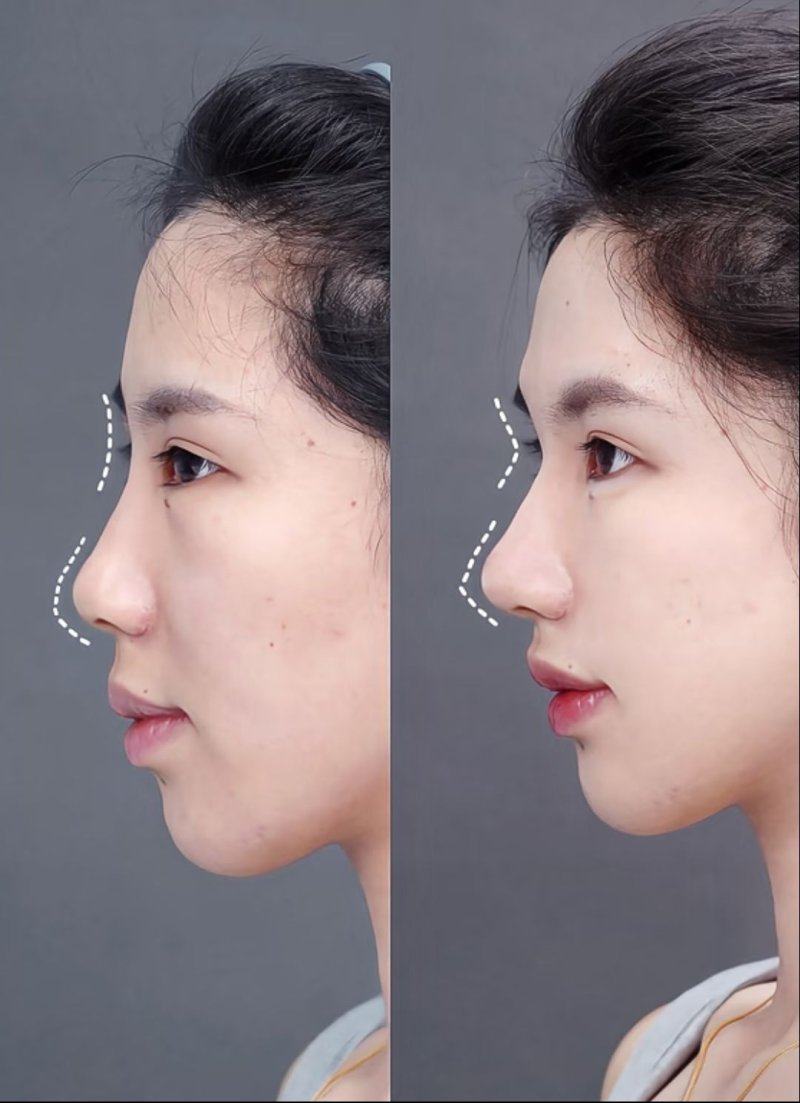 XX医院真人口碑评价怎么样？