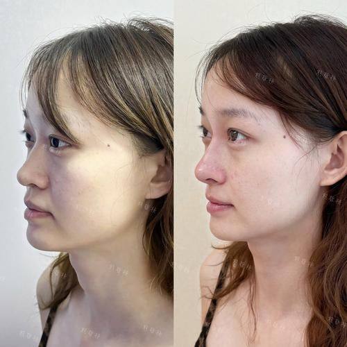 西安市铁路中 心医院烧伤整形科收费价格表/收费标准