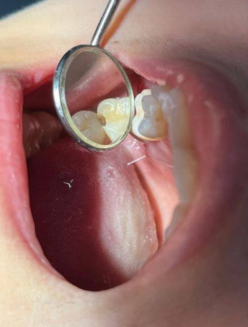 深圳维港欢乐口腔诊所地址电话营业时间