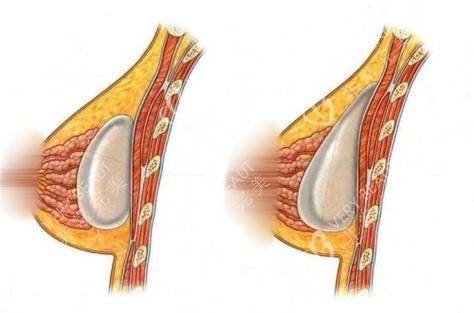 成都夏芙整形美容医院地址电话营业时间