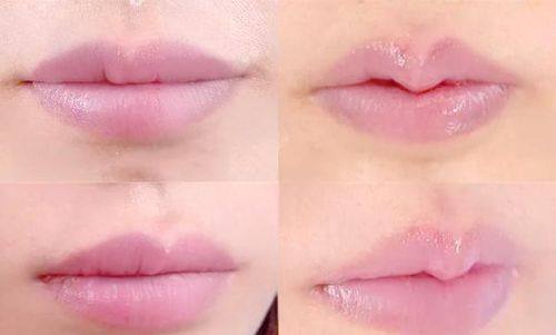 成都夏芙整形美容医院是正规医院吗？