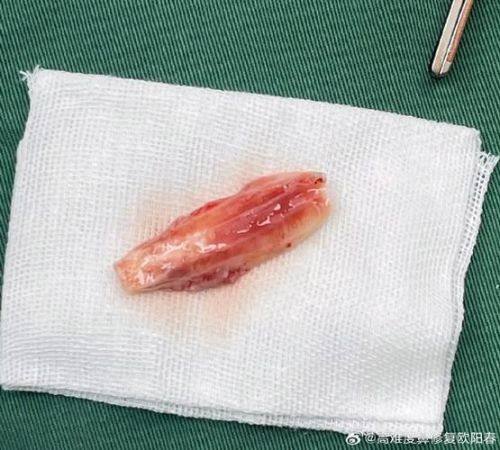 西安市铁路中 心医院烧伤整形科是正规医院吗？