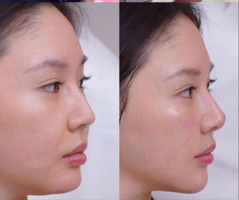 西安市铁路中 心医院烧伤整形科特色项目及技术优势