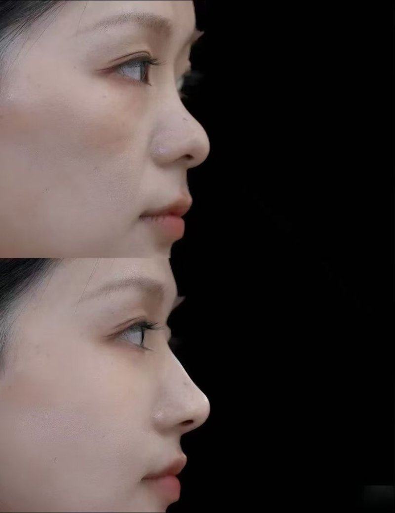 韩国Bommaru医院详细的预约挂号方式及流程