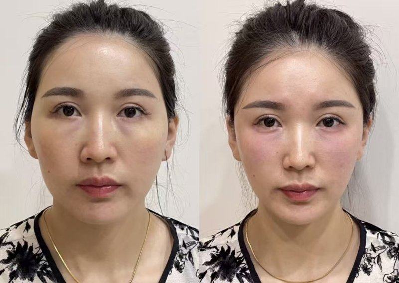 韩国Bommaru医院地址电话营业时间