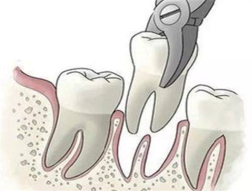 中山立波口腔门诊部收费价格表/收费标准