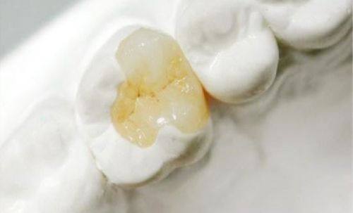 河南郑州悦好口腔真人口碑评价怎么样？