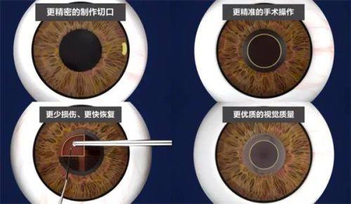 武汉中医和西医结合骨科医院眼科特色项目及技术优势