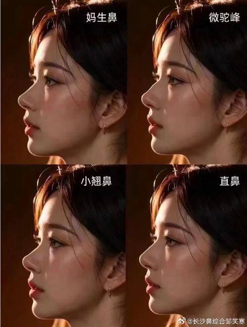 厦门银河整形医院真人口碑评价怎么样？