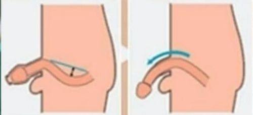 宁波北仑美塑名妍整形医院真人口碑评价怎么样？