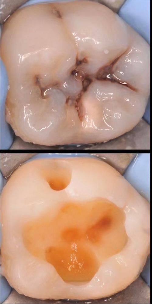 酒泉诺贝尔口腔医院特色项目及技术优势