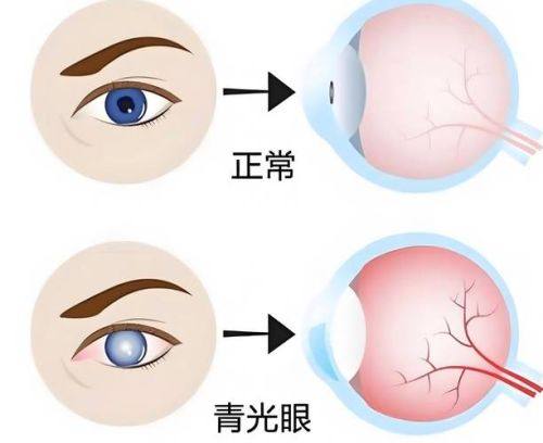 东莞华厦眼科医院详细的预约挂号方式及流程