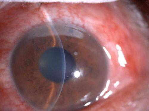 济南光正眼科医院详细的预约挂号方式及流程