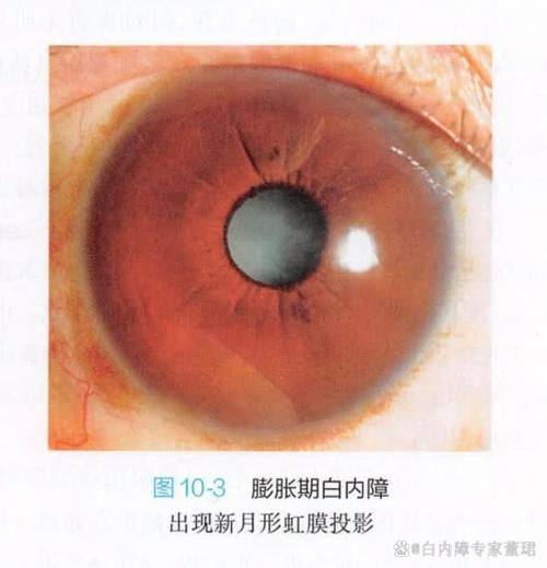 济南光正眼科医院真人口碑评价怎么样？