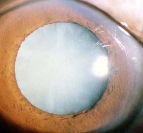 东莞华厦眼科医院是正规医院吗？